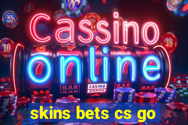 skins bets cs go