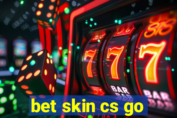 bet skin cs go