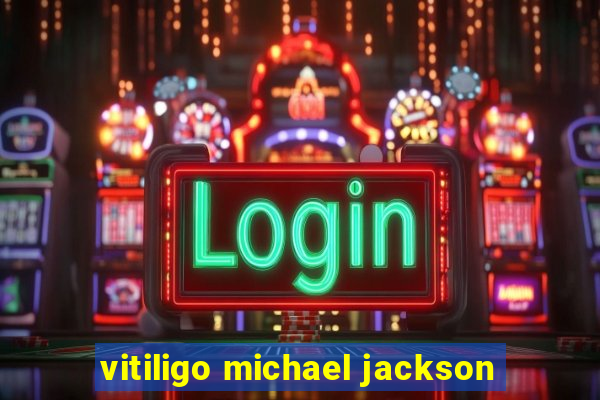 vitiligo michael jackson