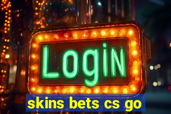 skins bets cs go