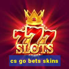 cs go bets skins